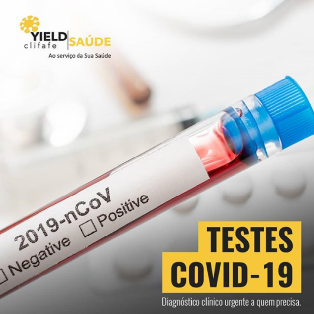 Disponibilização do Teste de Anticorpos Covid-19